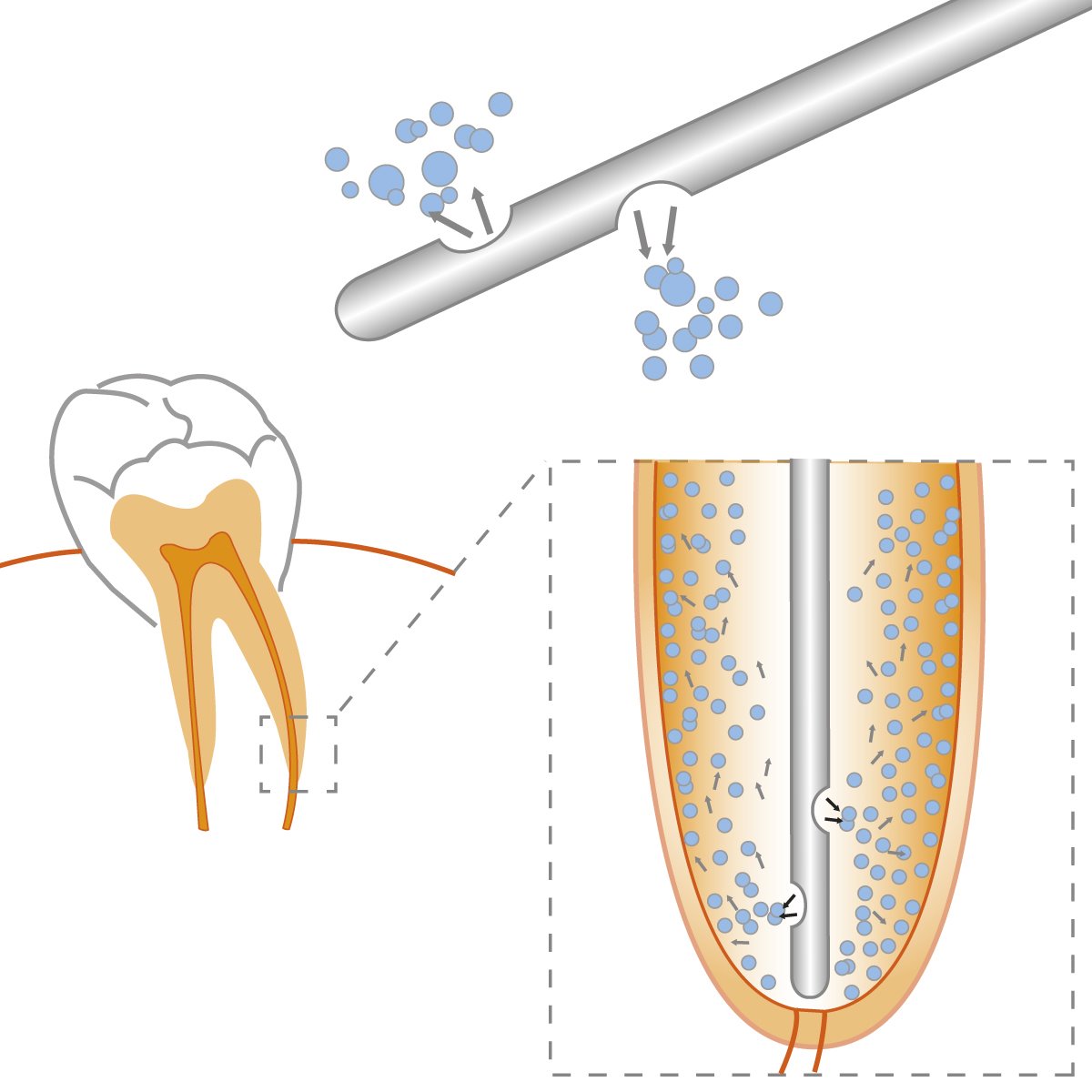 i-dental i-TIPS İRRİGASYON İĞNESİ ( 20'LİK )
