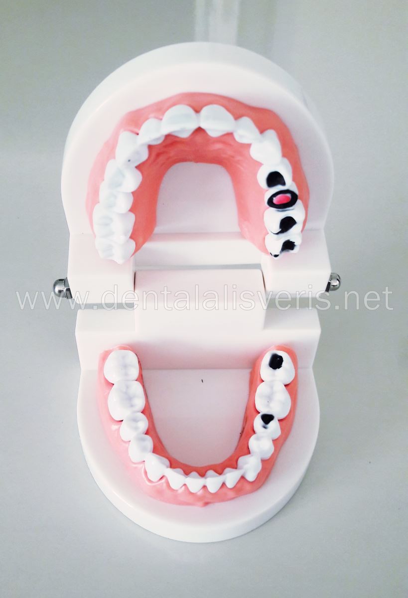 Periodontal Hasta Eğitim Modeli.