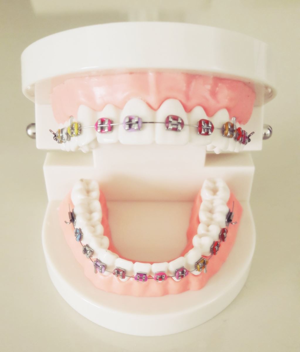 ORTODONTİK ÇENE EĞİTİM MODELİ.